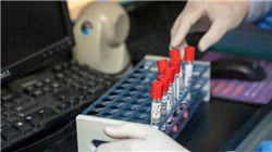 北路智控：截至2025年9月30日，公司股东人数为10888户